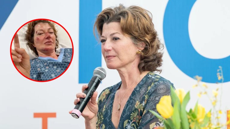 Amy Grant Recovering From Bike Accident