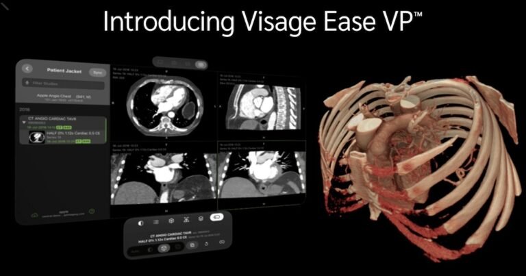 Visage Imaging launches diagnostic imaging platform for Apple Imaginative and prescient Professional