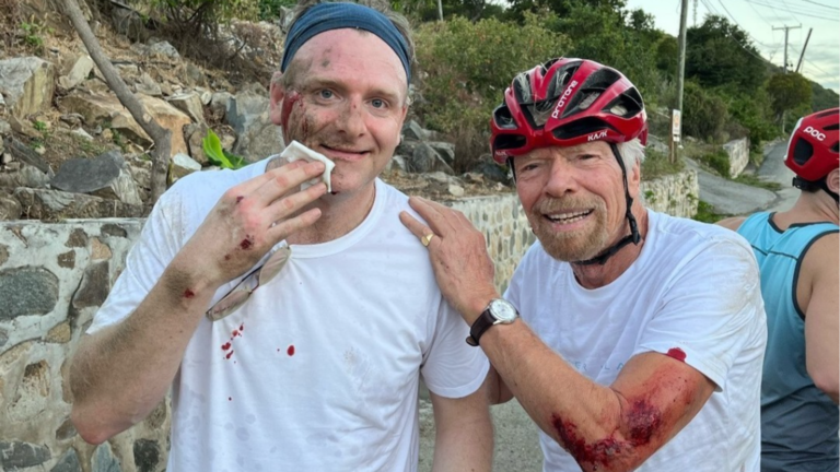 Richard Branson suffers ‘nasty’ accidents in biking accident | World Information